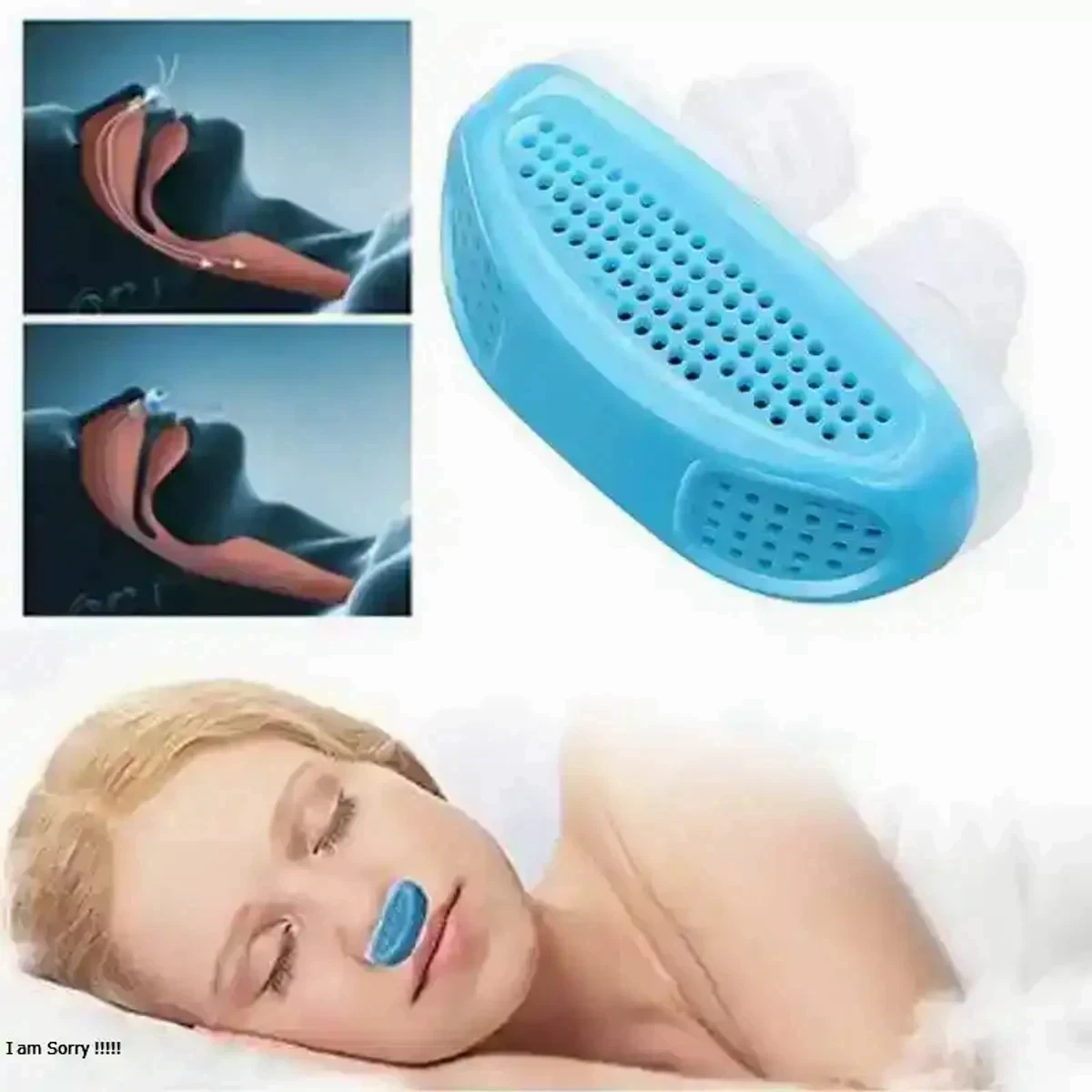 নাক ডাকার মেশিন Anti Snoring Device - Image 3